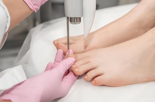 Nail Fungus Treatments